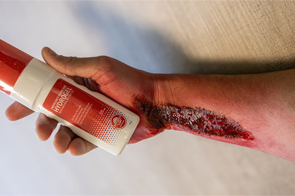 Brandwondengel aanbrengen op armwond, eerste hulp product.